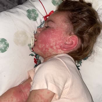 Büyük Anadolu Hastanesi Darıca Yaşatılan Mağduriyet!