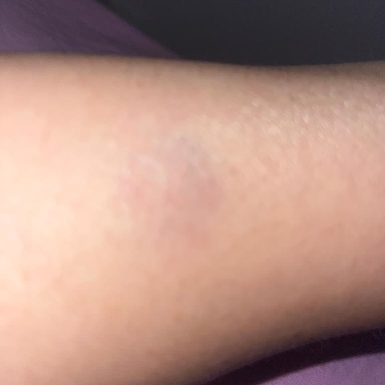 Vitrin Sahne Eğlenmeye Gidip Çalışan Tarafından Darba Uğradım, Polis Çağırdım