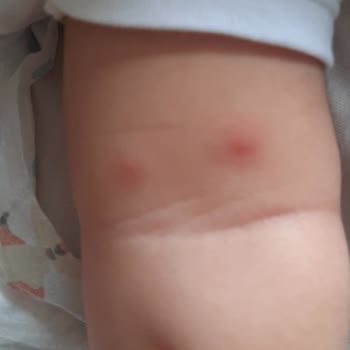 Kepez Belediyesi Sinek İlaçlama Yapılması Yok