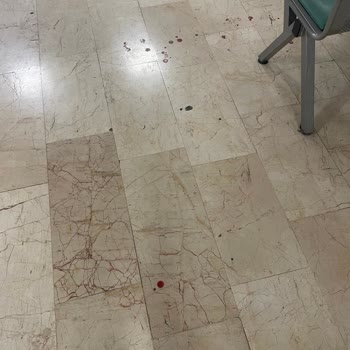 Dokuz Eylül Üniversitesi Tıp Fakültesi 38 Derece Ateşle Getirdiğim Kanser Hastası Anneme Çok Geç Bakıldı