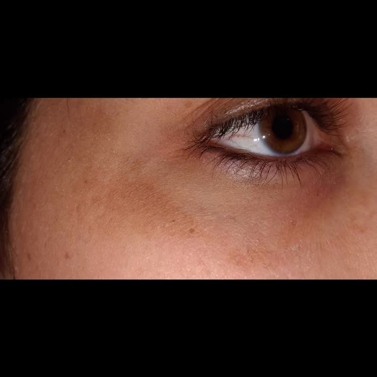 The Prime Beauty Merkez (theprime. Beauty) Yosun Peeling Pişmanlığı