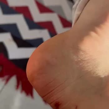 Nike Konfor Vaat Eden Ayakkabıdan Beklenmedik Rahatsızlık