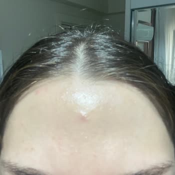 Watsons Pure Beauty BB Krem Sivilce Siyah Nokta Ve Beze Yapıyor