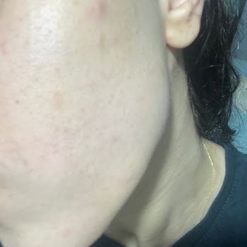 Watsons Pure Beauty BB Krem Sivilce Siyah Nokta Ve Beze Yapıyor