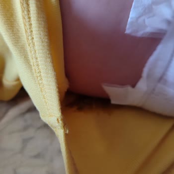 Sleepy Bebek Bezi Sızdırma Sorunu Ve Yıkama Yorgunluğu