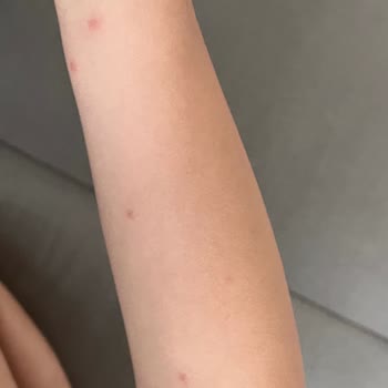 Nurse Harvey’s Nurse Harvey Organik Böcek Kovucu İşe Yaramıyor!