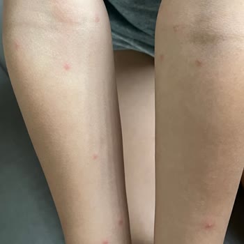 Nurse Harvey’s Nurse Harvey Organik Böcek Kovucu İşe Yaramıyor!