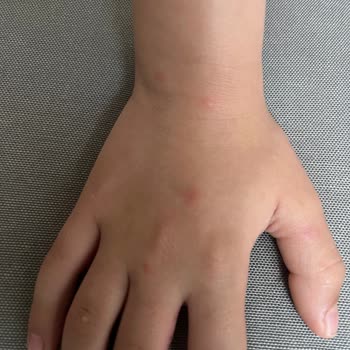 Nurse Harvey’s Nurse Harvey Organik Böcek Kovucu İşe Yaramıyor!