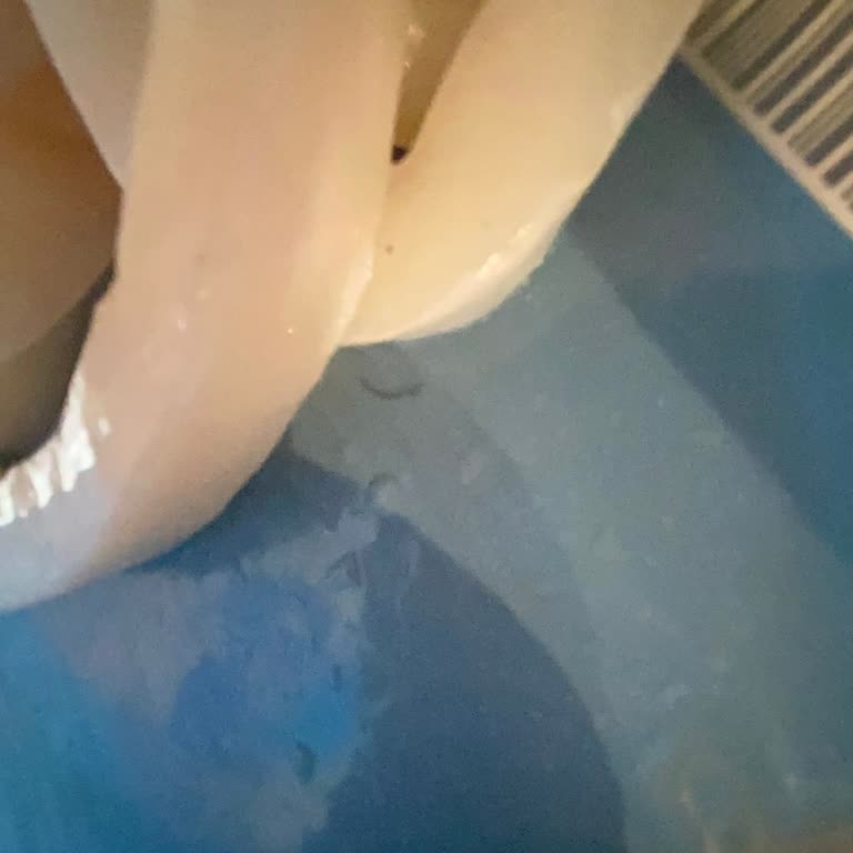 Erba Sea Food Kalamardan Kıl Çıktı