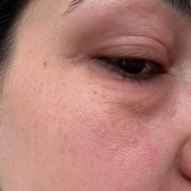 Gratis Göz Çevren Şişti Kaşınıyor Ve Kızarık