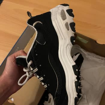 Skechers Marka Ayakkabıda Garanti Yalanı!