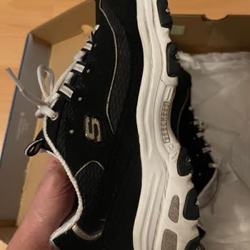 Skechers Marka Ayakkabıda Garanti Yalanı!