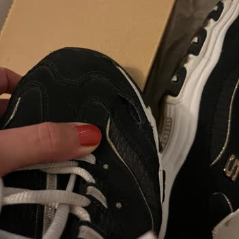 Skechers Marka Ayakkabıda Garanti Yalanı!