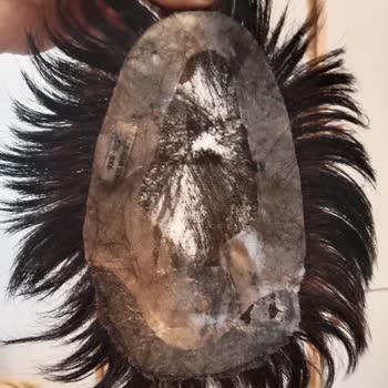 Konya Protez Saç Ali Yıldız Hayal Kırıklığına Uğratan Protez Saç Deneyimi