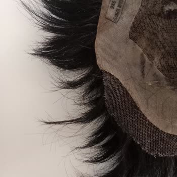 Konya Protez Saç Ali Yıldız Hayal Kırıklığına Uğratan Protez Saç Deneyimi