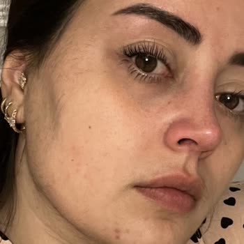 Aris Güzellik Merkezleri VIP Güzellik Merkezinde Yaşanan Epilasyon Problemleri