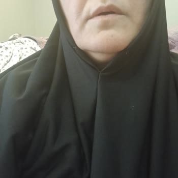 Pratikksal (Instagram) Sattıkları Ürünün Arkasında Durmuyorlar!