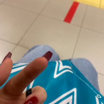 Sena Özkan Beauty Protez Tırnak Yamukluğu, Olmamışlığı