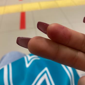 Sena Özkan Beauty Protez Tırnak Yamukluğu, Olmamışlığı