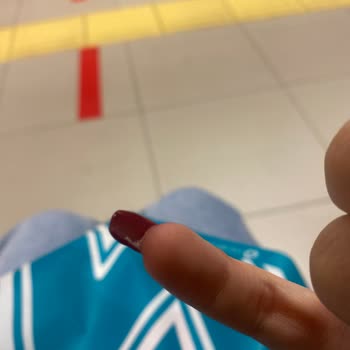 Sena Özkan Beauty Protez Tırnak Yamukluğu, Olmamışlığı