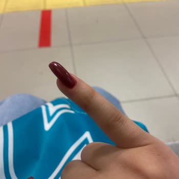 Sena Özkan Beauty Protez Tırnak Yamukluğu, Olmamışlığı