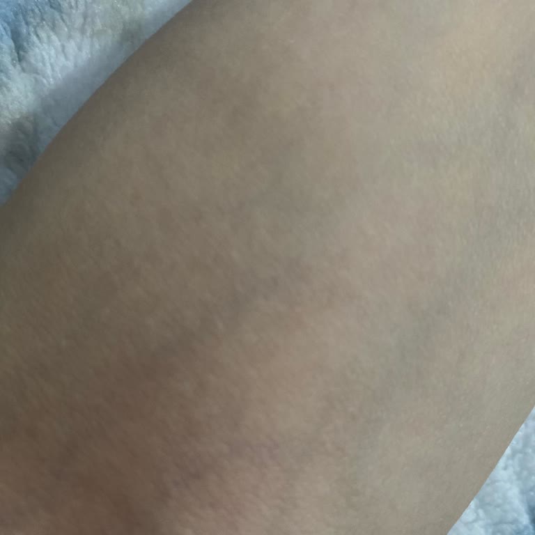 Edis Pharma İlaç İlaç Etkinliği Konusunda Yaşanan Hayal Kırıklığı