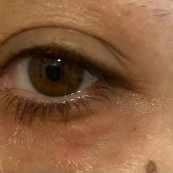 Yves Rocher Göz Kremi Alerji Sorunu