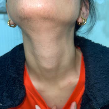 Rosso Beauty Mağdur Edildim Sonuç Alamadım