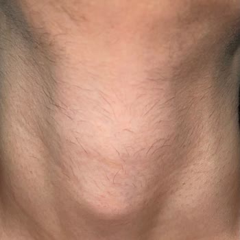 Rosso Beauty Mağdur Edildim Sonuç Alamadım