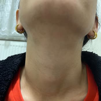 Rosso Beauty Mağdur Edildim Sonuç Alamadım