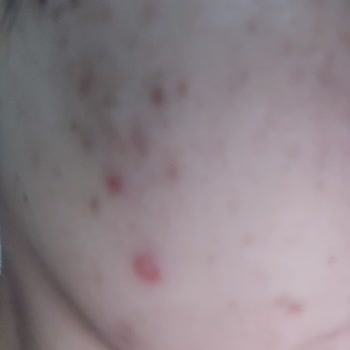 Nivea Cellular Luminous Leke Serumu Hk.