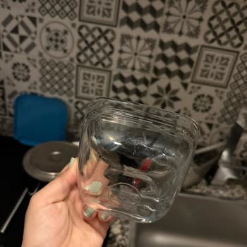 Beko Servisi İşini Yapmıyor