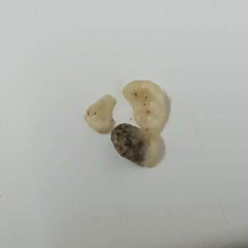 Altıntop Kuruyemiş Fıstık Yerine Sosla Kaplanmış Taş Çıktı