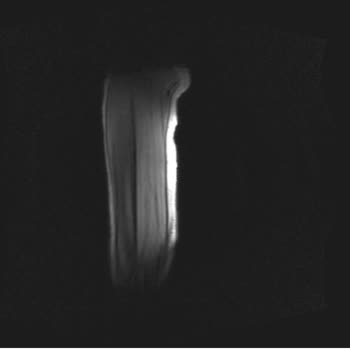 Open attachment