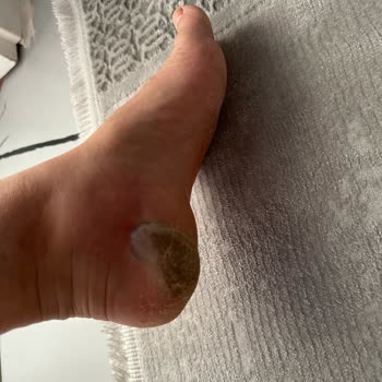 Özel Optimed Hastanesi Optimed Hastanesi Kürdan Üzerine Gittiğim Şikayet