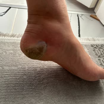 Özel Optimed Hastanesi Optimed Hastanesi Kürdan Üzerine Gittiğim Şikayet