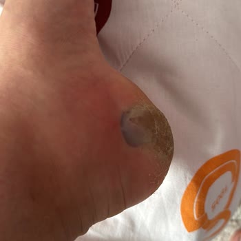 Özel Optimed Hastanesi Optimed Hastanesi Kürdan Üzerine Gittiğim Şikayet