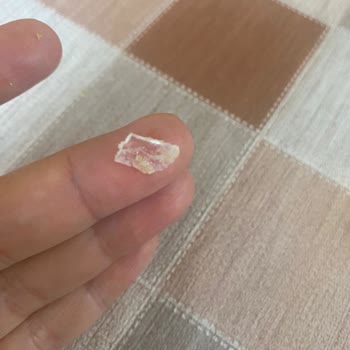 Harras Hamburger Ekmeğinden Cam Çıktı!