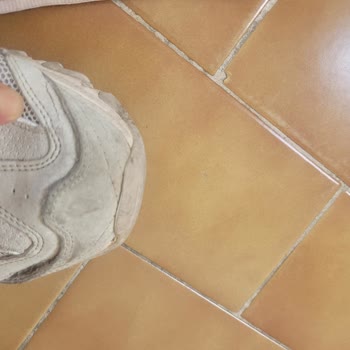 Skechers D Lite Ayakkabı Patladı Ve Sorun Giderilmiyor.