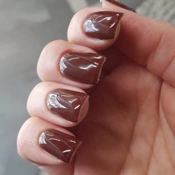 Beauty Seher Ergün Kötü İşlem Ve İlgisizlik