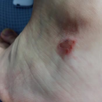 In Street Puma Marka Ayakkabım Aşırı Vurma Yapıyor