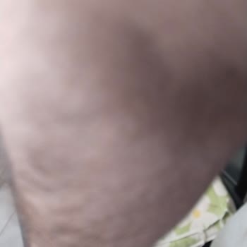 Bornova Türkan Özilhan Devlet Hastanesi Sağlık Ekibi Doktoru Keyfi Hastaya Bakmıyor