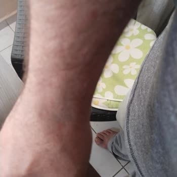 Bornova Türkan Özilhan Devlet Hastanesi Sağlık Ekibi Doktoru Keyfi Hastaya Bakmıyor