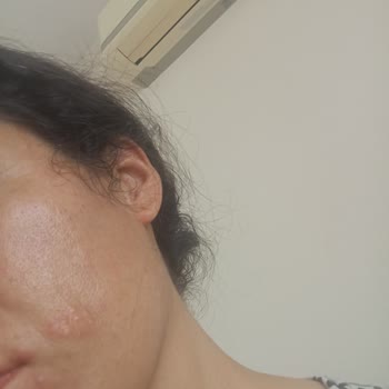 The Purest Solutions The Purest Şikayet