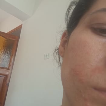 The Purest Solutions The Purest Şikayet