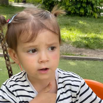Mustela Güneş Losyonu Alerji Yaptı