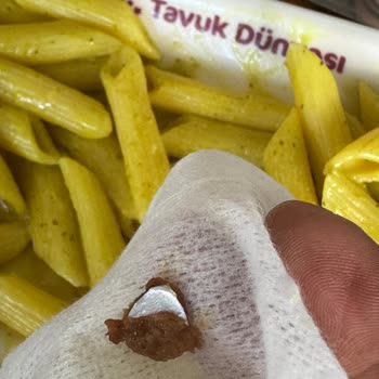 Tavuk Dünyası Tavukta İstenmeyen Madde