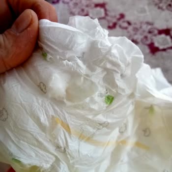 Sleepy Ekonomik Bez Yırtık Çıktı