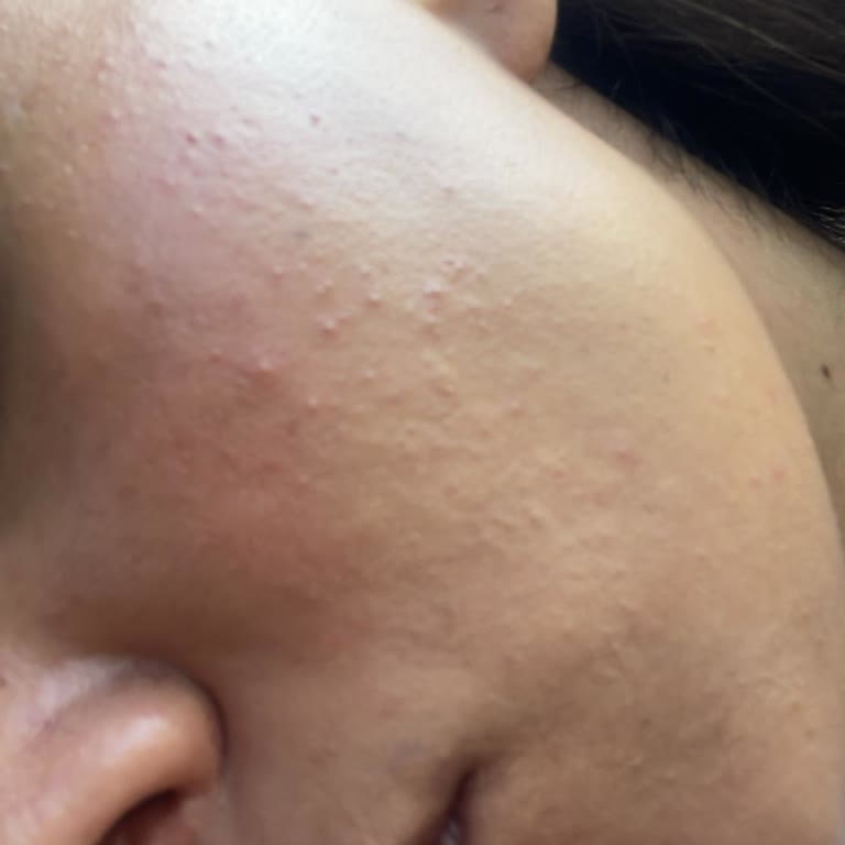 Maruderm Salisik Asitli Yüz Yıkama Jeli Satışı Yasaklanmalı