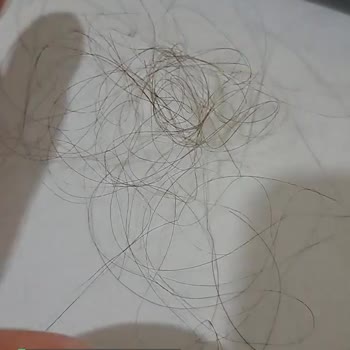 Pantene Saç Dökülmesi Karşıtı Şampuan Saç Döküyor!